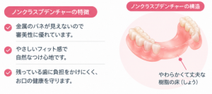 上下顎のノンクラスプデンチャー解説